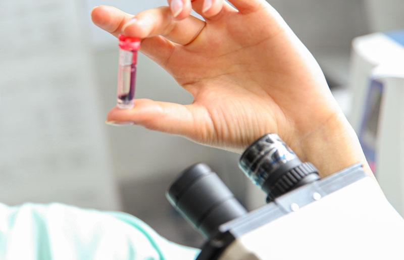 Babesien können im Blut nachgewiesen werden